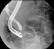 ERCP 1