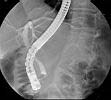 ERCP 2